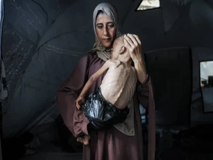غزہ میں شدید غذائی قلت کا شکار بچوں کی تعداد 28 ہزار سے تجاوز کرگئی